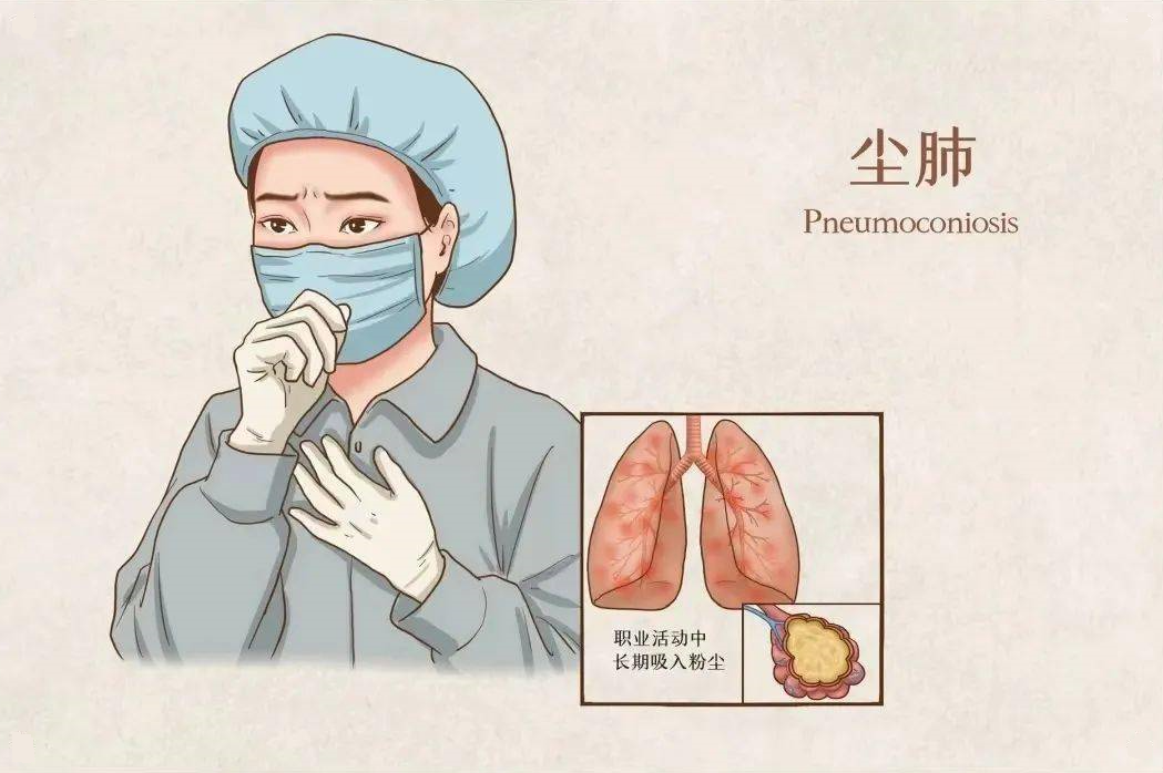 一张丢失的诊断书，一次寻常的查房——湘潭县人民医院为尘肺农民工点亮希望